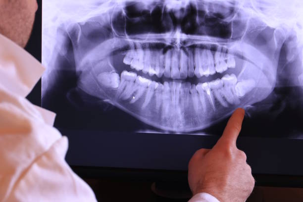 Best Urgent Tooth Repair  in Savannah, TN